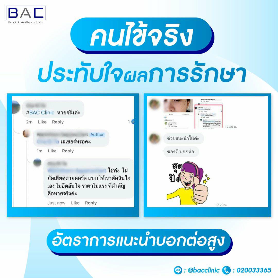 Pico laser ที่ไหนดี รักษาฝ้า กระ รอยสิว หลุมสิว รีวิวคนไข้จริงเท่านั้น-BAC Clinic